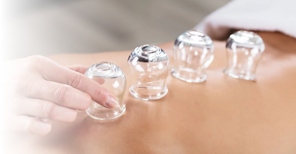 Can Acupuncture Help Treat Insomnia? Understanding the Science and Real Stories