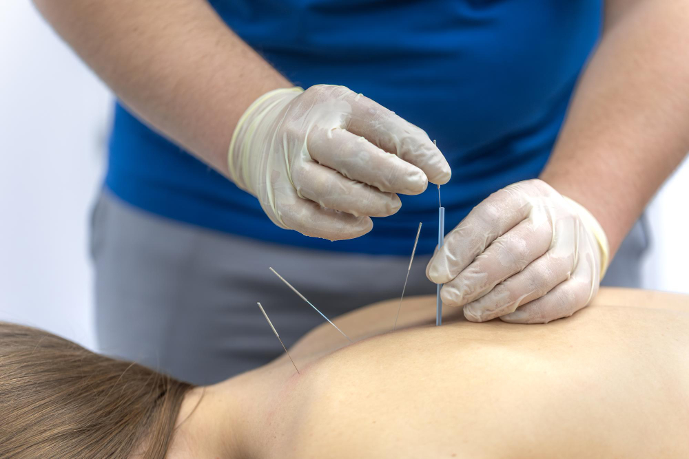 Acupuncture Treatment for Sciatica