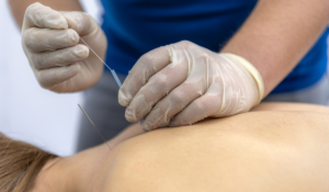 choosing the right acupuncture clinic