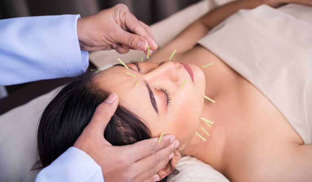 Facial Cosmetic Acupuncture