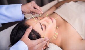 Facial Cosmetic Acupuncture